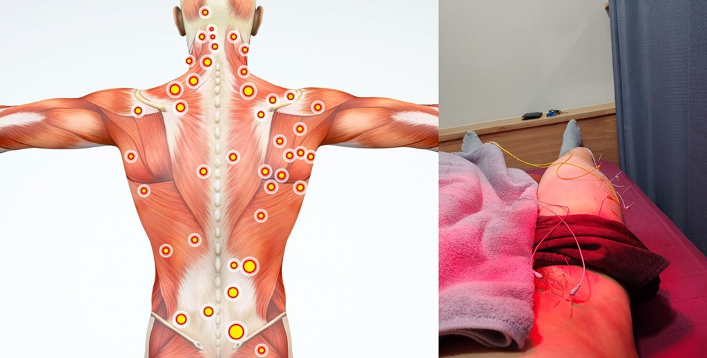 어쩌면_당신 이야기_통증_근섬유통_섬유근통_치료.jpg