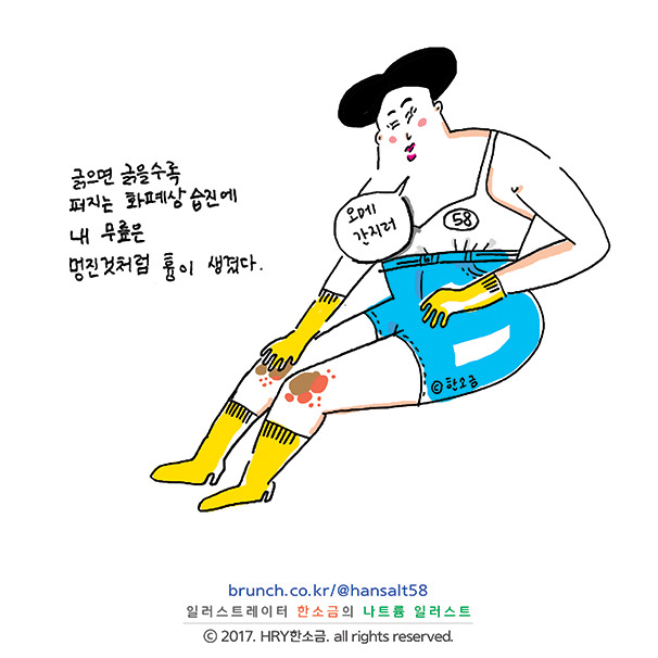 FIRE비비_한소금(HRY)_@HANSALT58_습진공쥬3.jpg