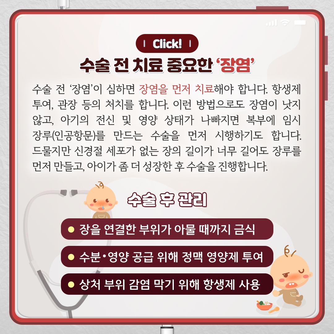 선천성거대결장_06.jpg
