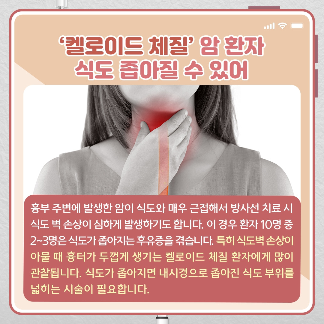 방사선 치료_07.jpg