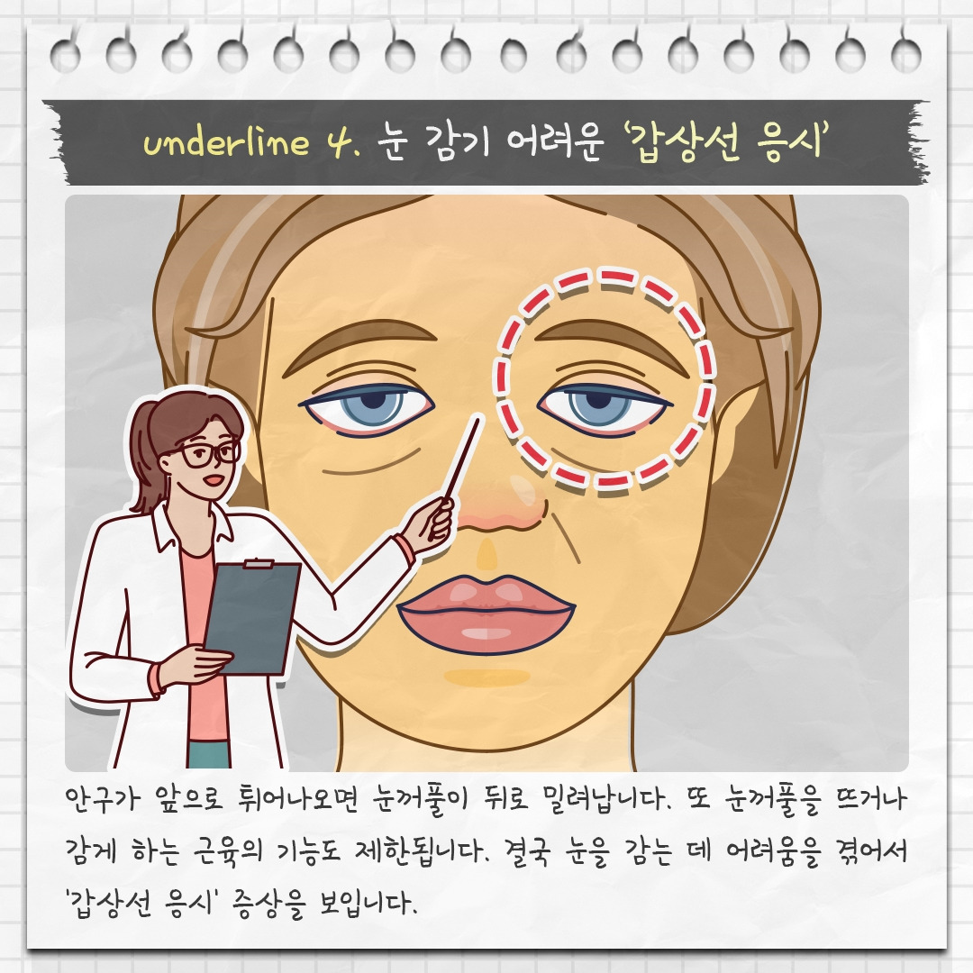 갑상선 눈질환_07 .jpg