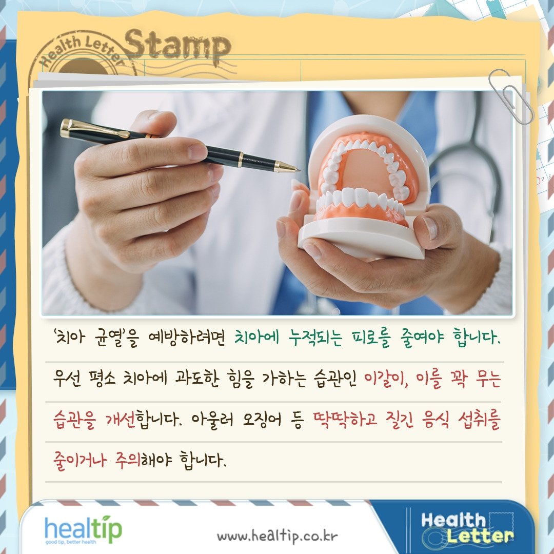 치아 균열_06_힐팁.jpg