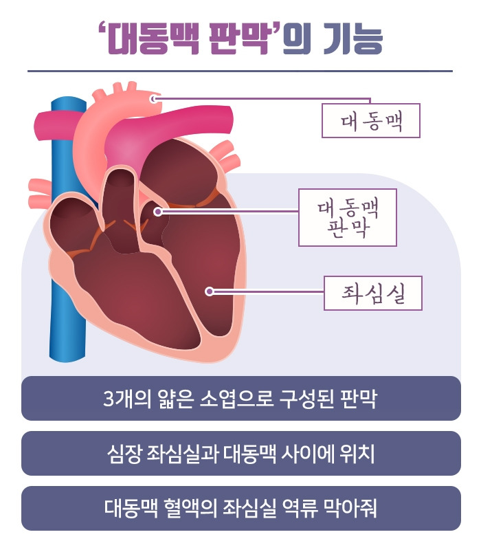 대동맥 판막 협착증_04.jpg