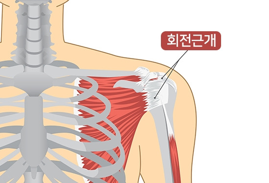Shoulder-Pain-Vector_어깨,회전근개1.jpg