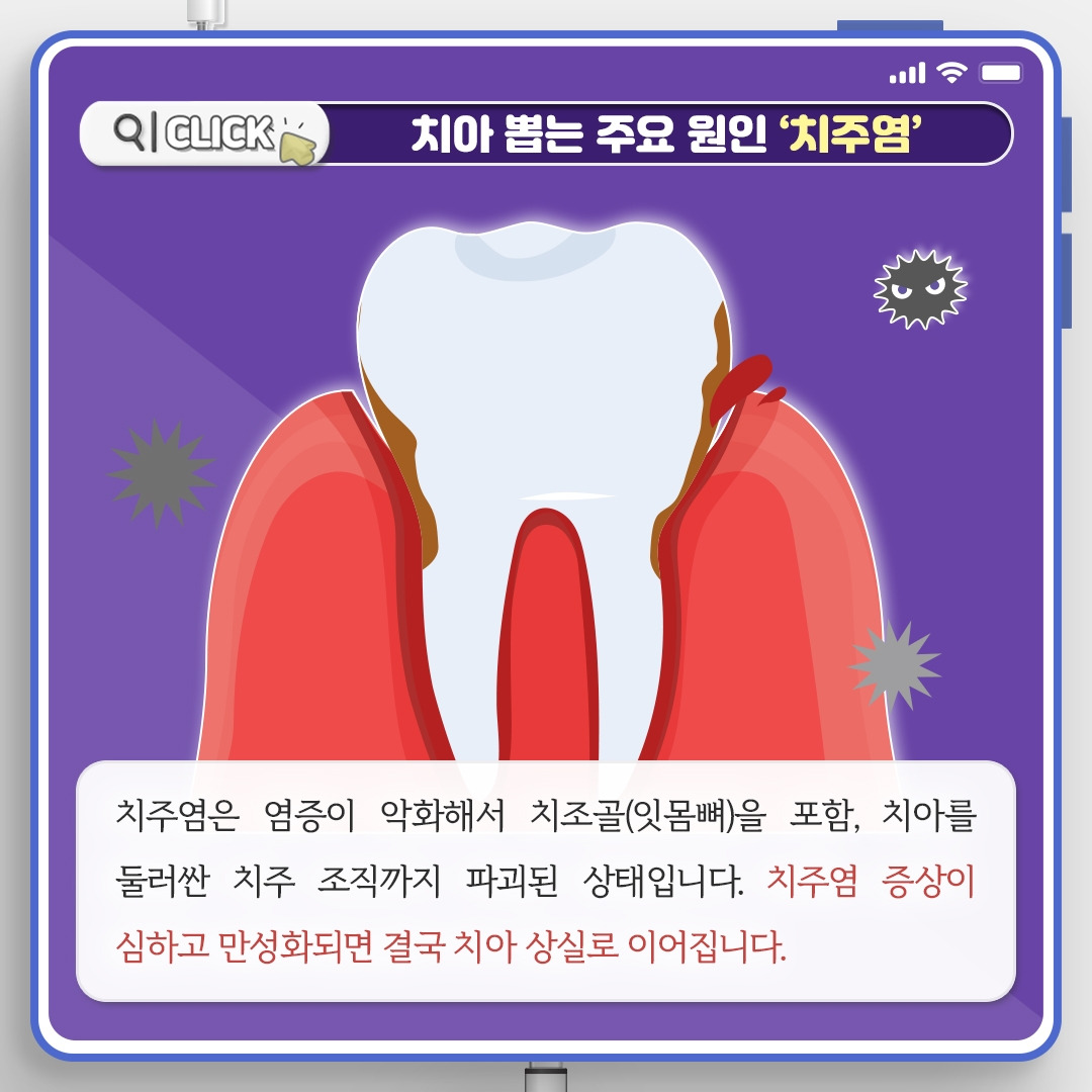 치주질환_04.jpg