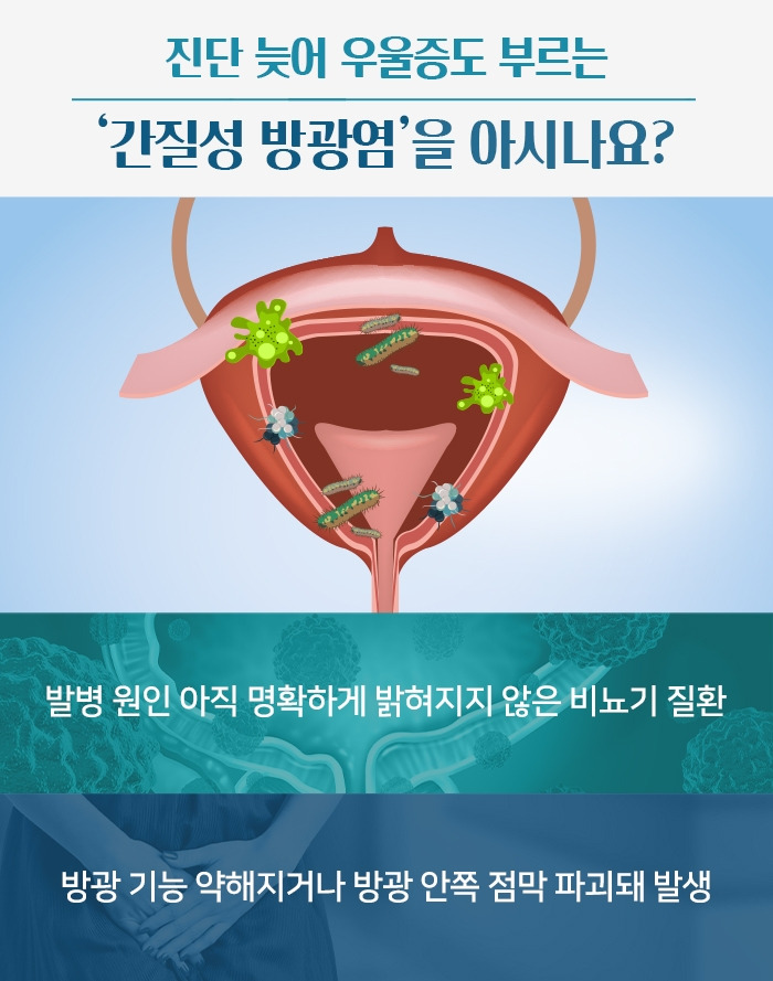 간질성 방광염_1.jpg