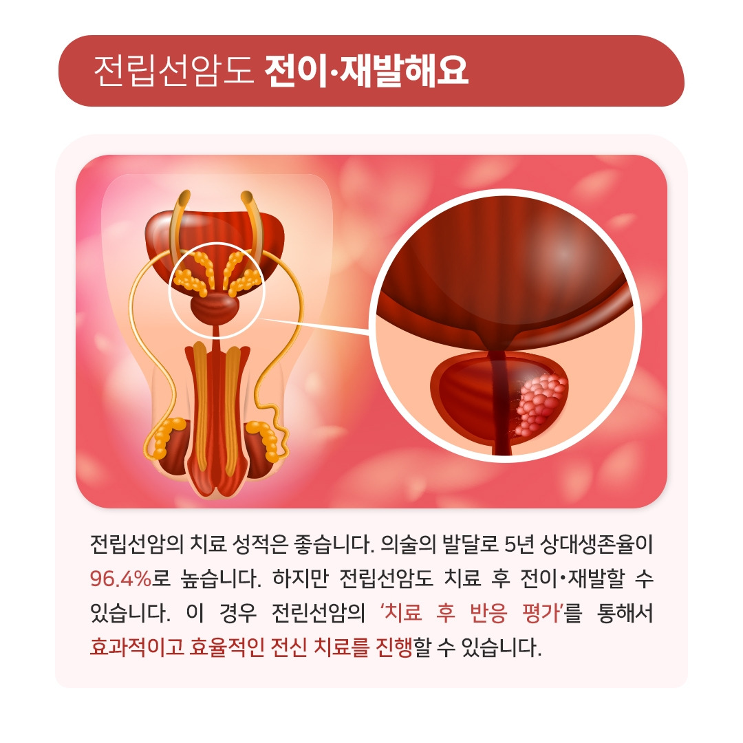 전립선암_03.jpg