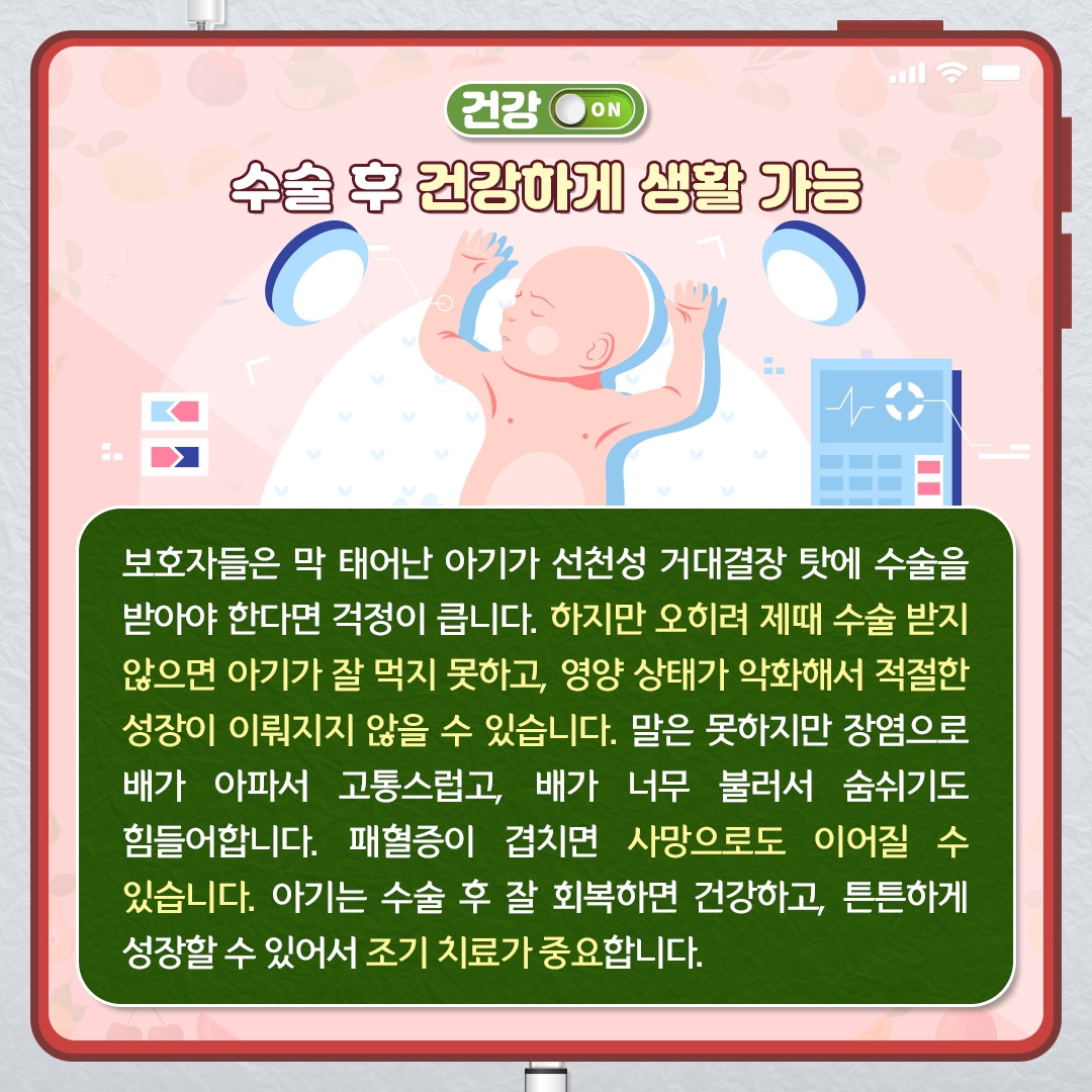 선천성거대결장_08.jpg
