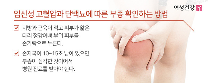 ※임신성 고혈압과 단백뇨에 따른 부종 확인하는 방법.jpg