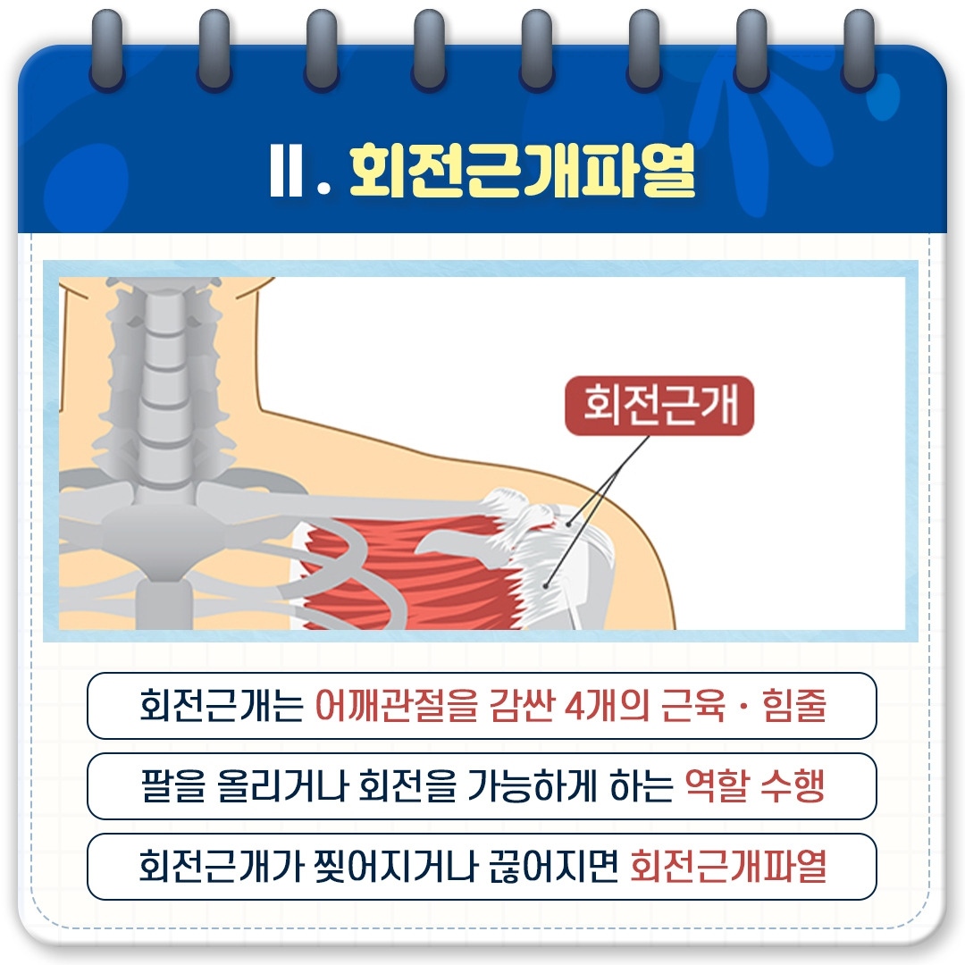 회전근개파열_04.jpg