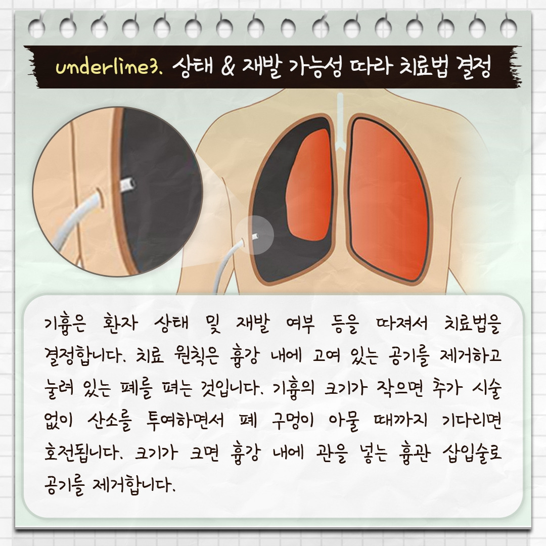 기흉_07.jpg