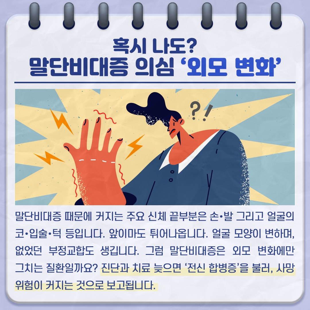 말단비대증_03 .jpg