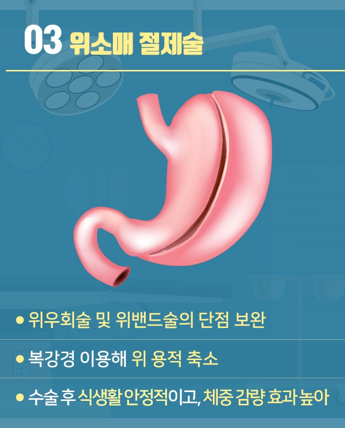 대사비만수술_06.jpg