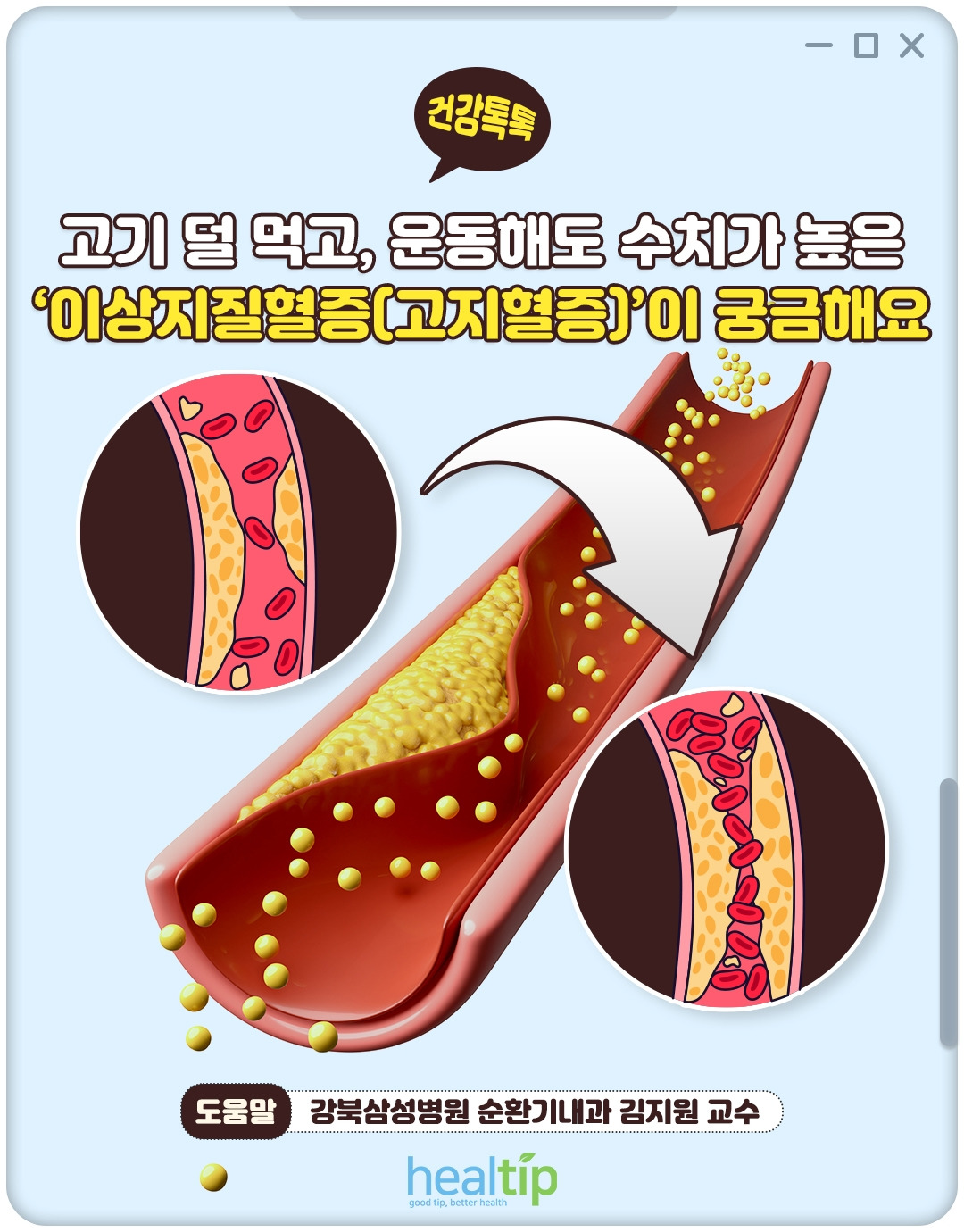 이상지질혈증_01_힐팁.jpg