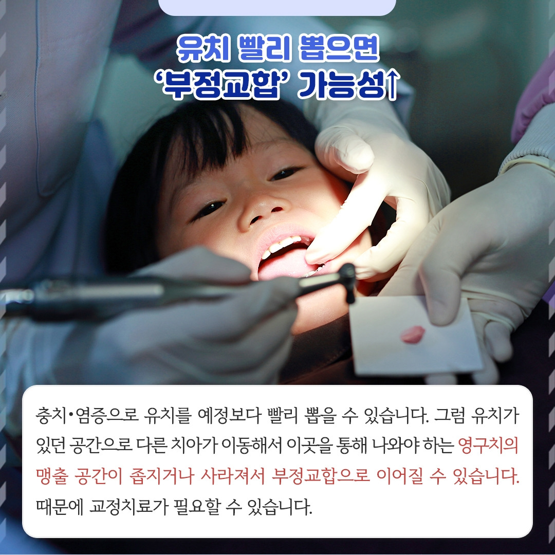 소아교정치료_03.jpg