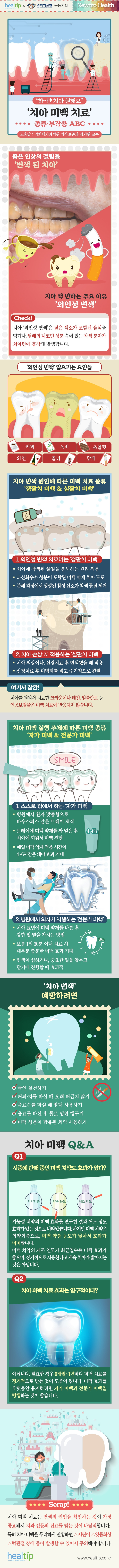 치아미백_230216_힐팁.jpg