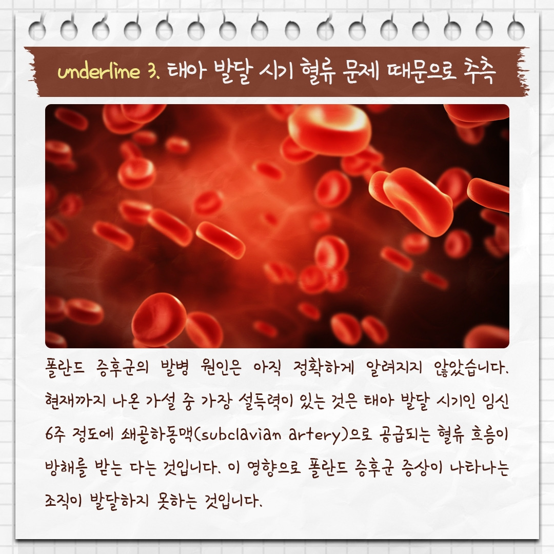 폴란드증후군_06 .jpg