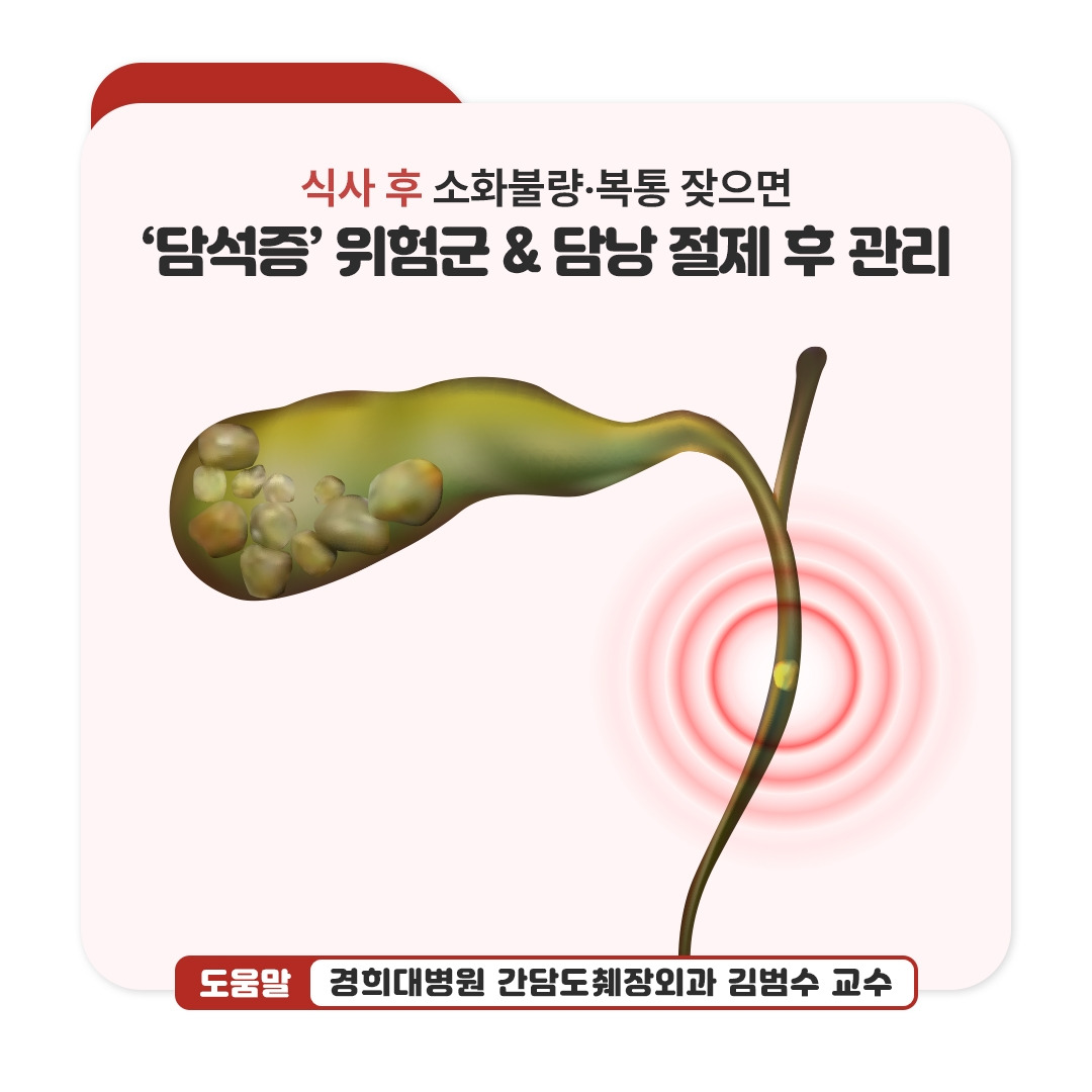 담석증_01.jpg