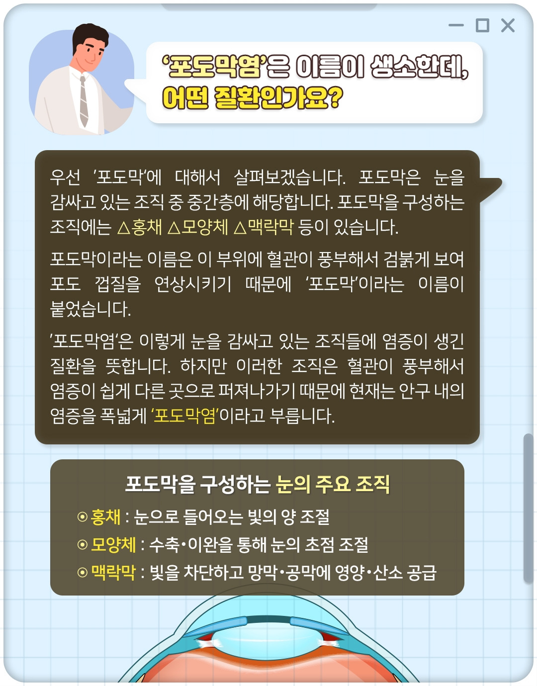 포도막염_03.jpg