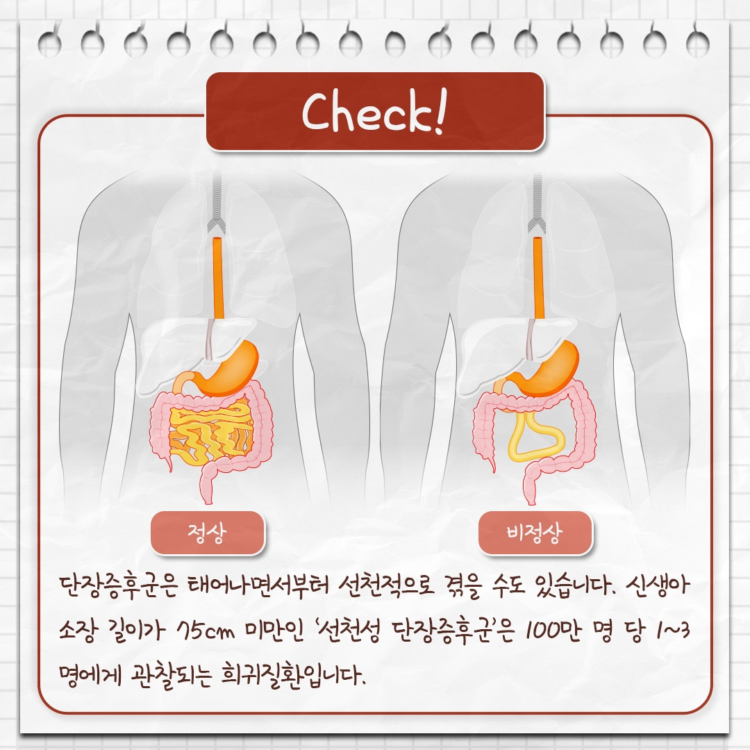 단장증후군_03 .jpg