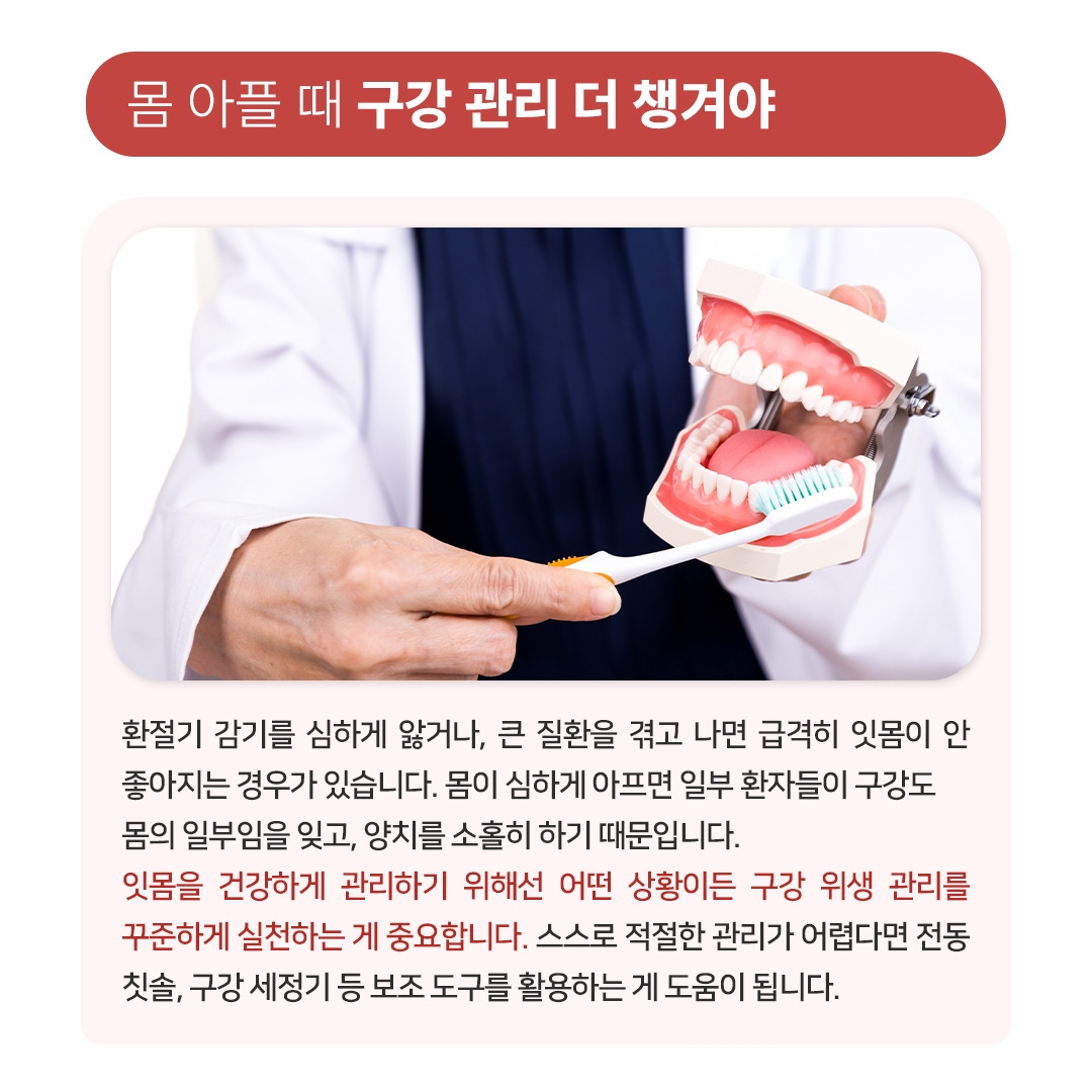 환절기잇몸병_04.jpg