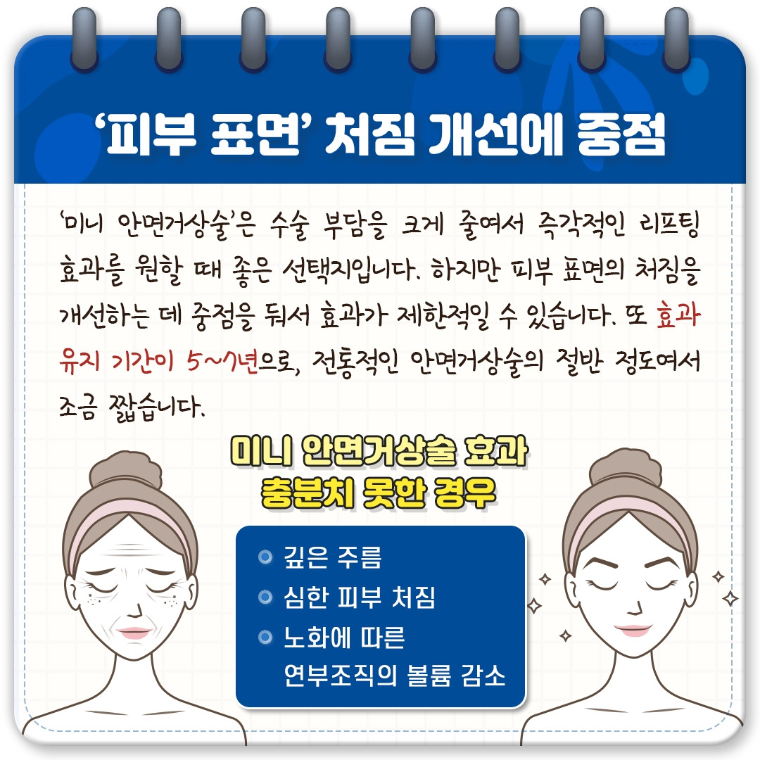 안면거상_04.jpg