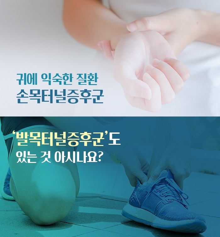 발목터널증후군_1.jpg