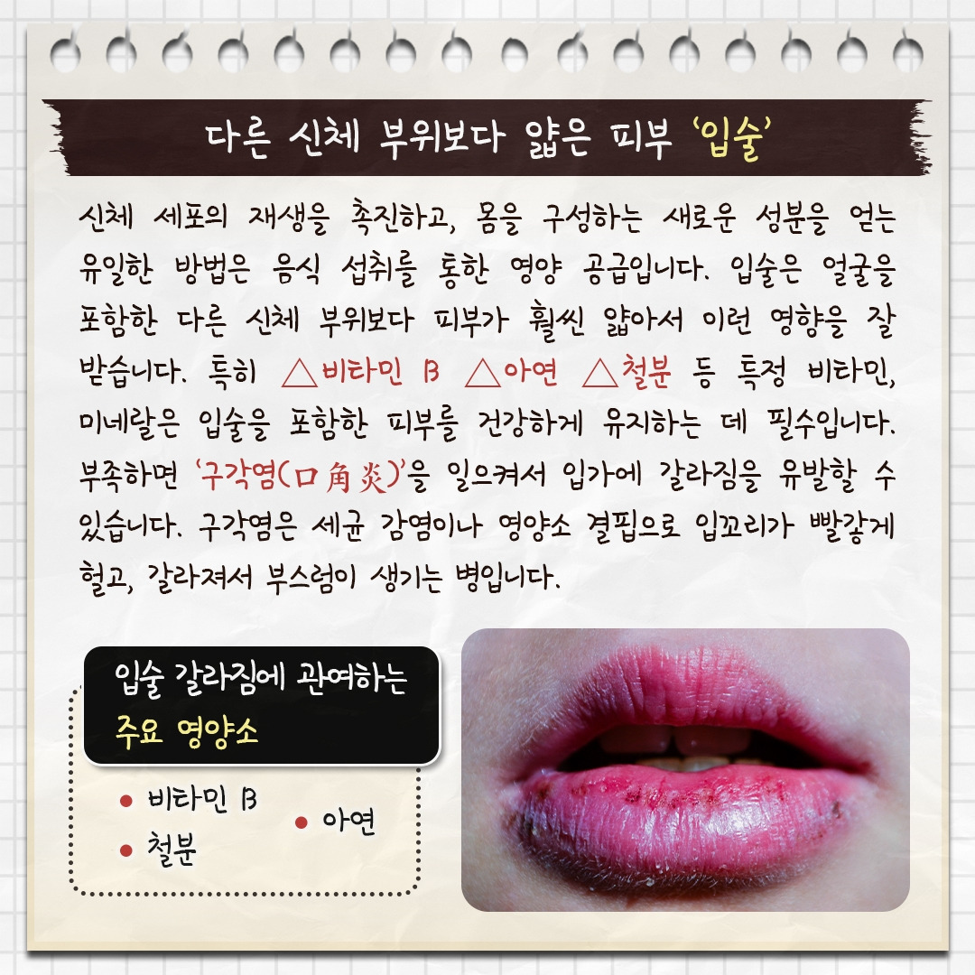 입술건조증_03.jpg