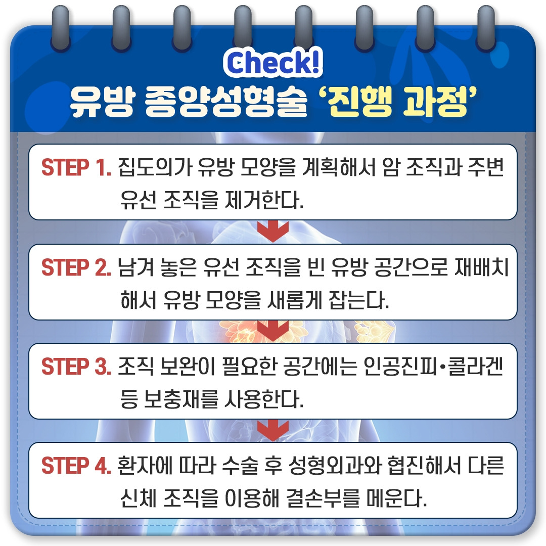 유방 종양 성형설_04.jpg