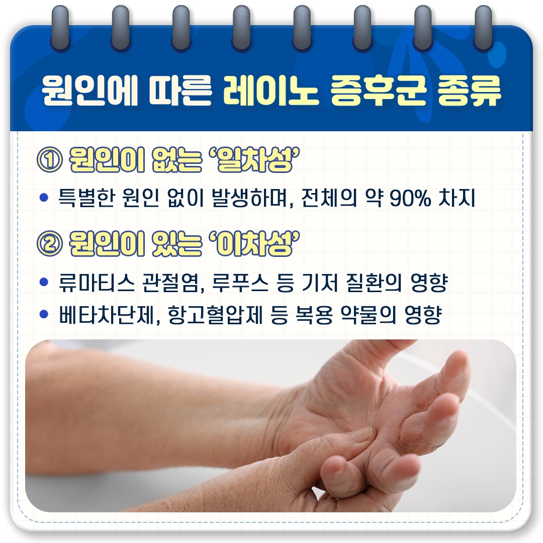 레이노증후군_03.jpg