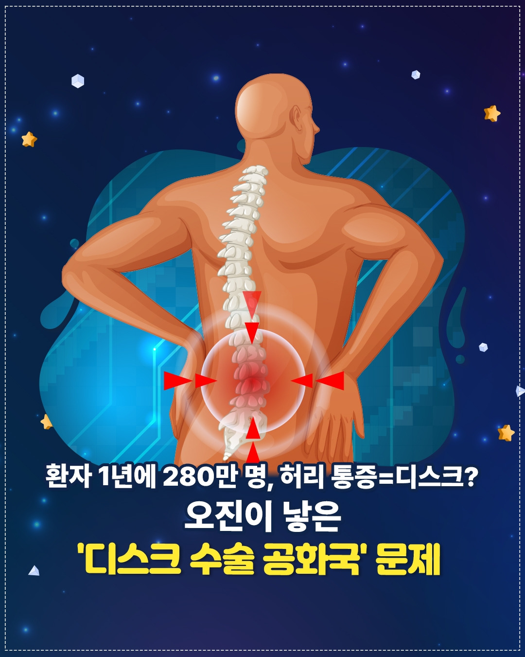 허리디스크_01.jpg