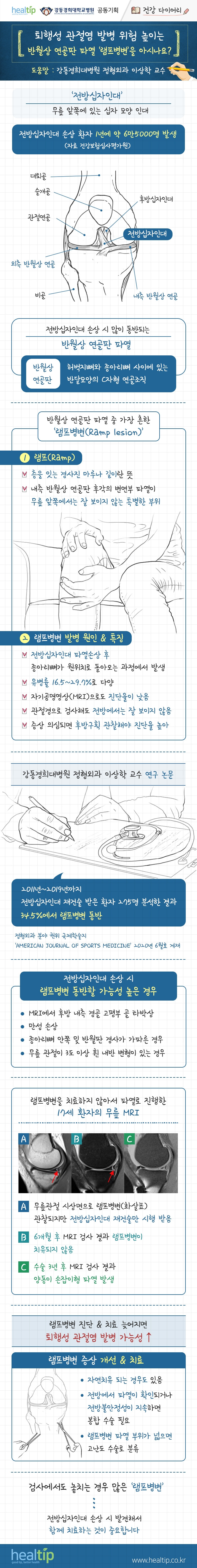 강동경희대병원422-반월상 연골판 파열 & 램프병변 (건강 다이어리).jpg