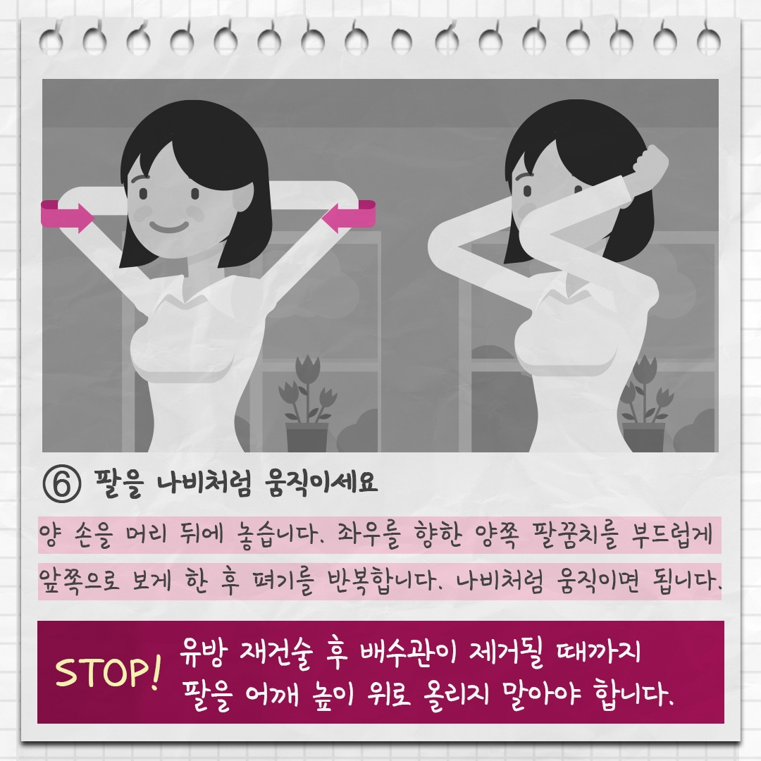 유방재건술 9.jpg