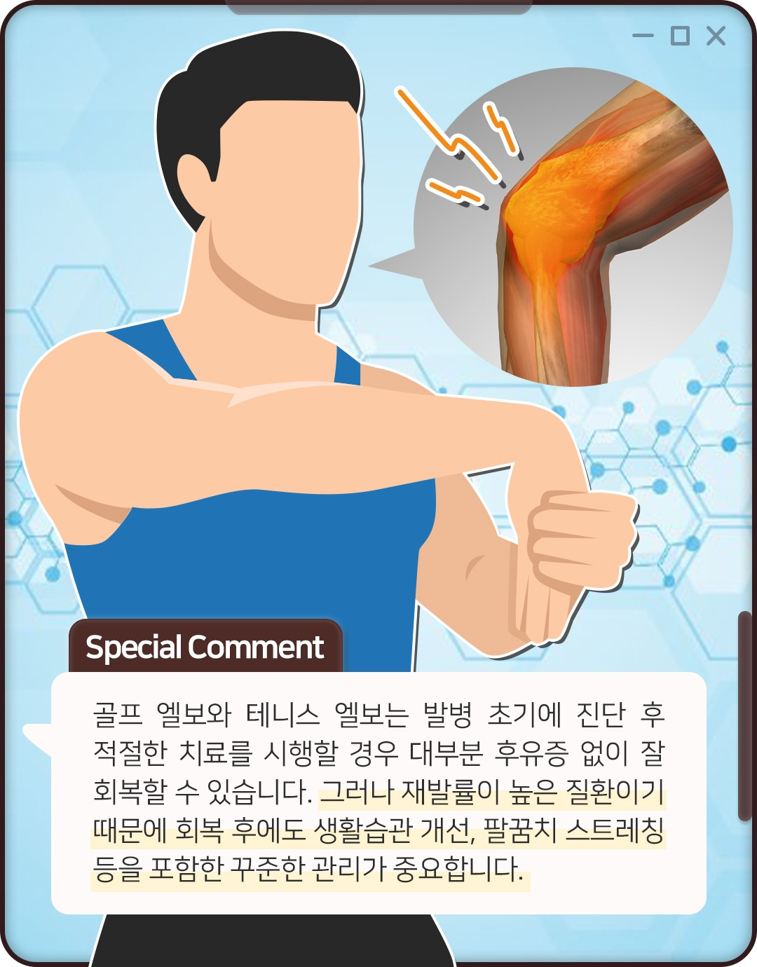 팔꿈치 통증_09_힐팁 .jpg