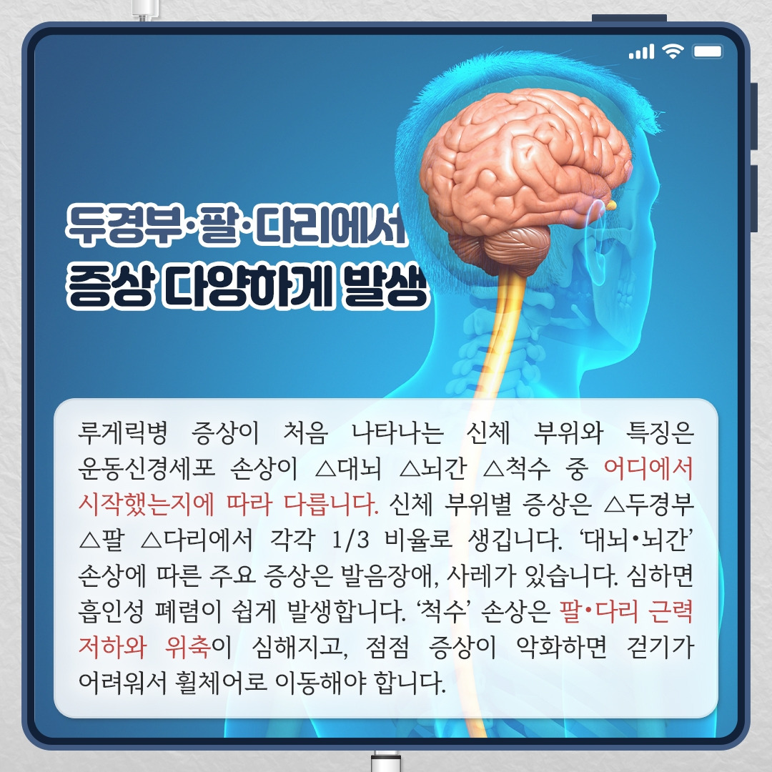 루게릭_03.jpg