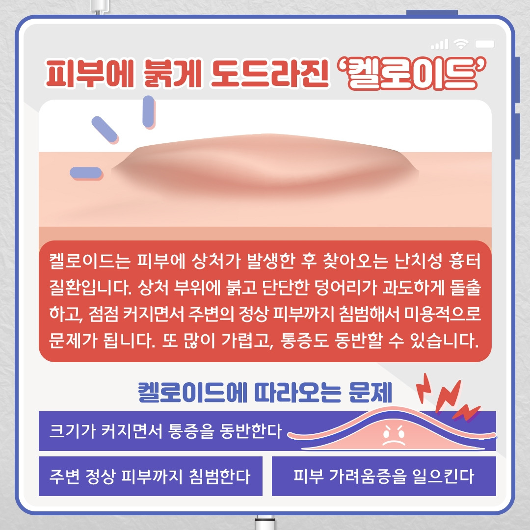켈로이드_02 .jpg