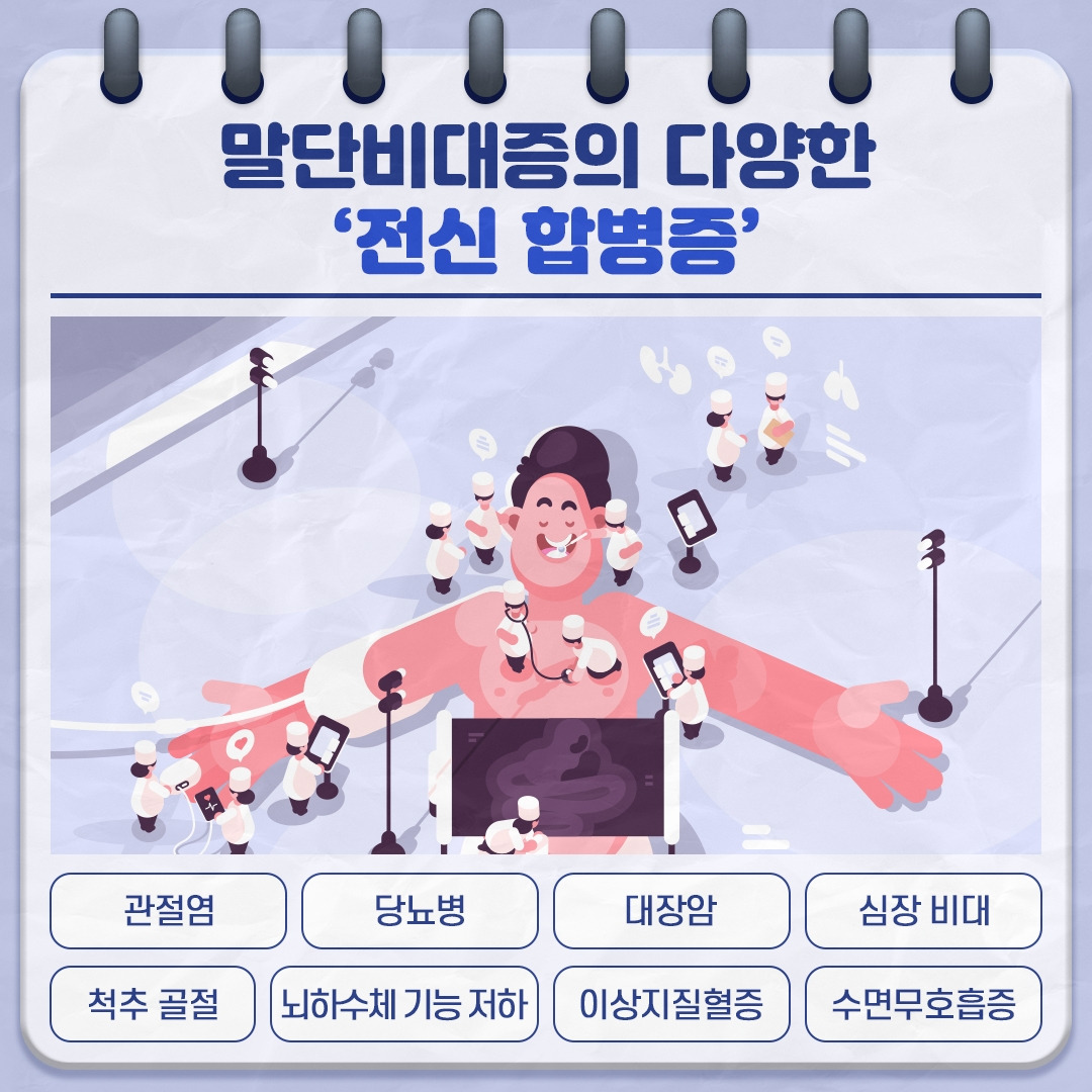 말단비대증_04.jpg
