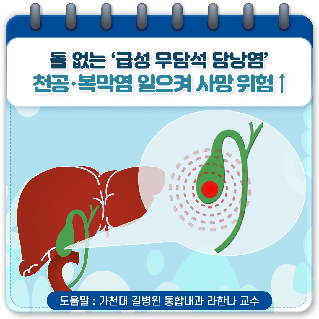 무결석 담낭염_01.jpg
