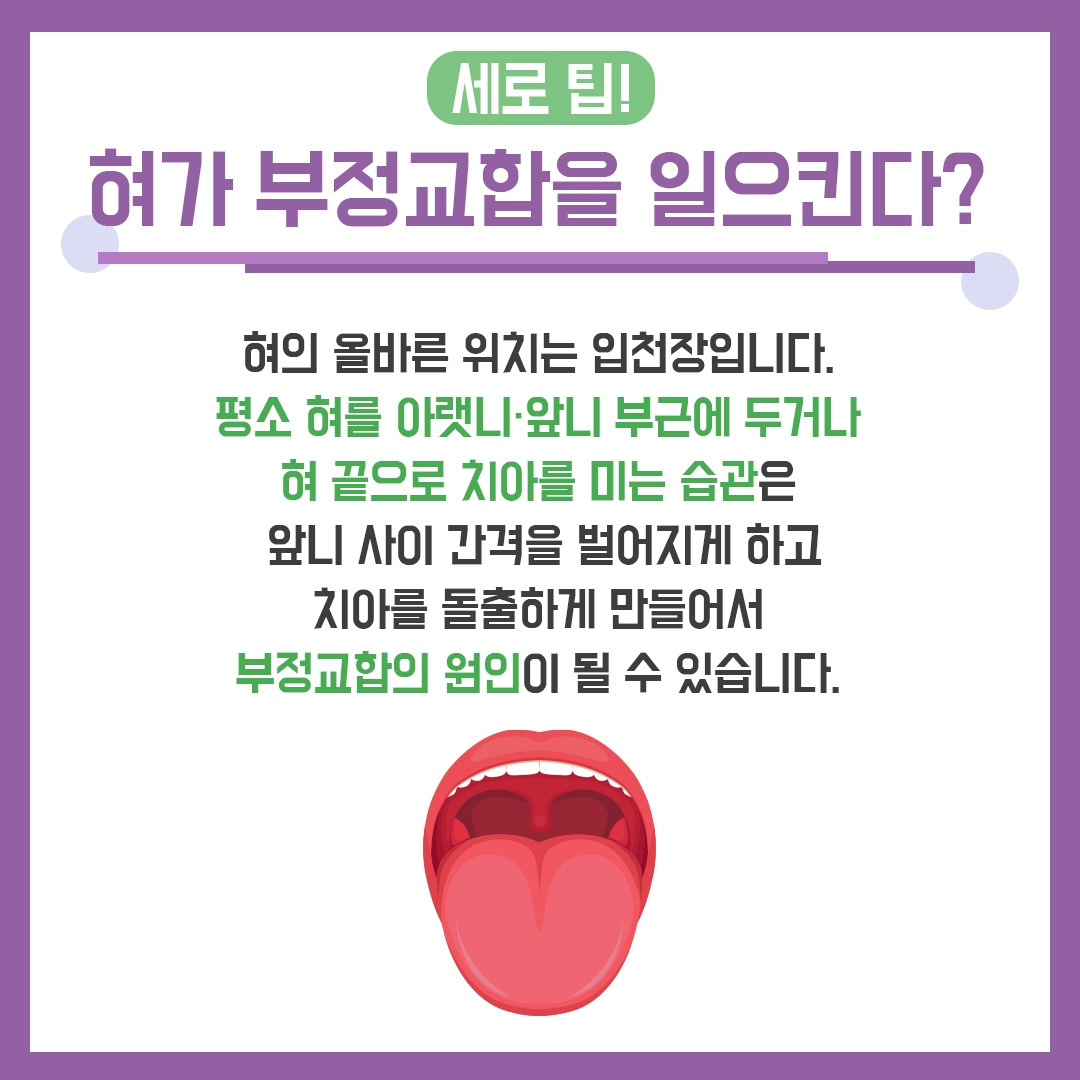 부정교합6.jpg