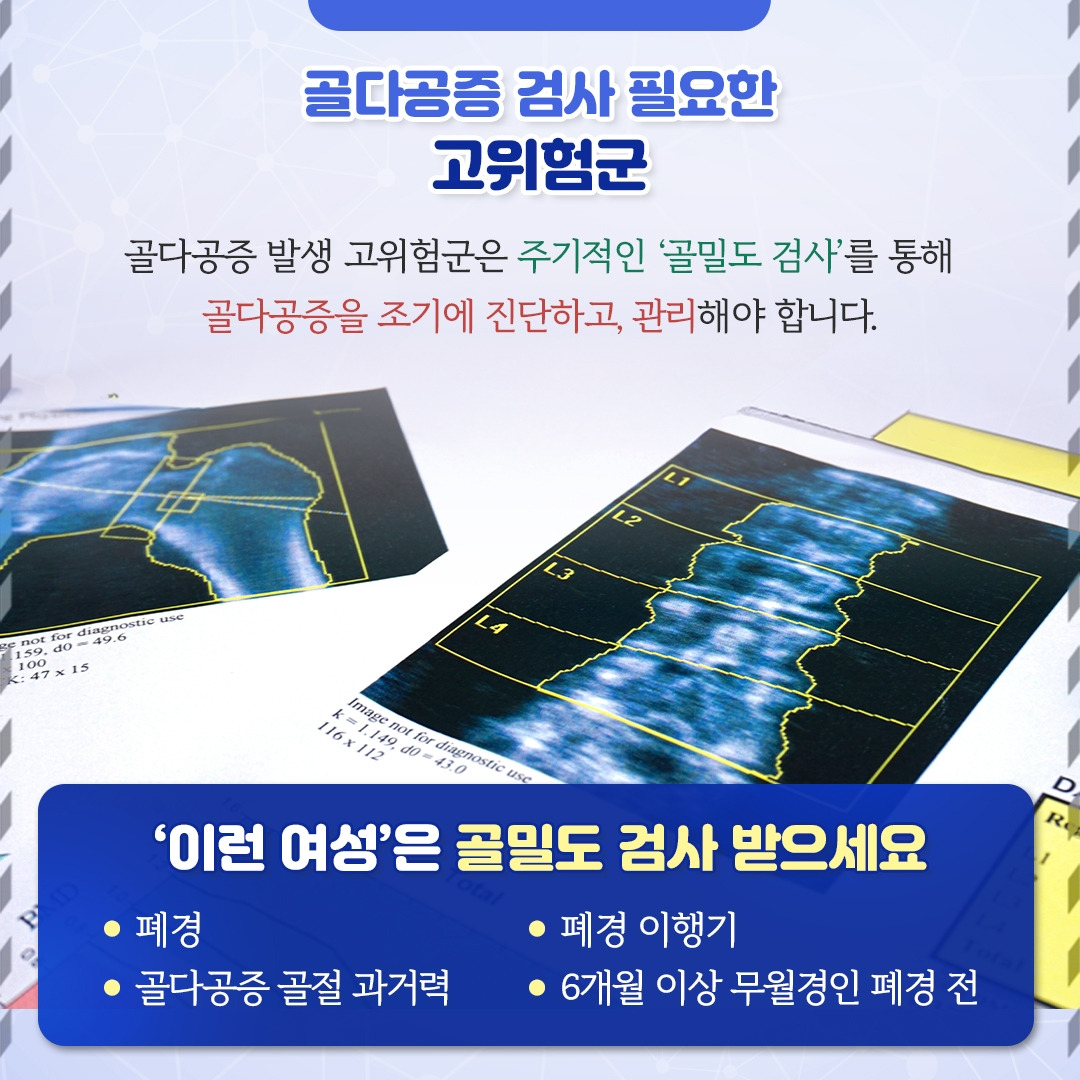 골다공증_06.jpg
