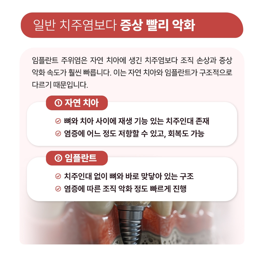 임플란트주위염_05.jpg