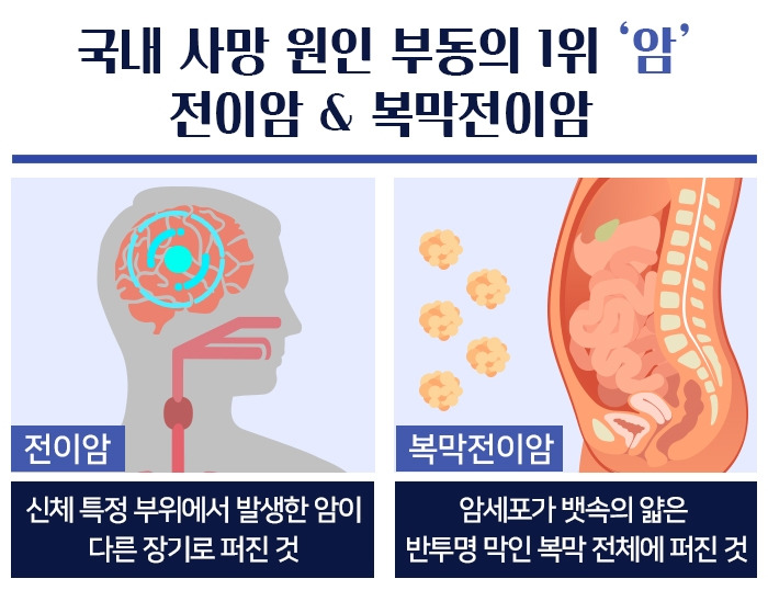 복막전이암_02 .jpg