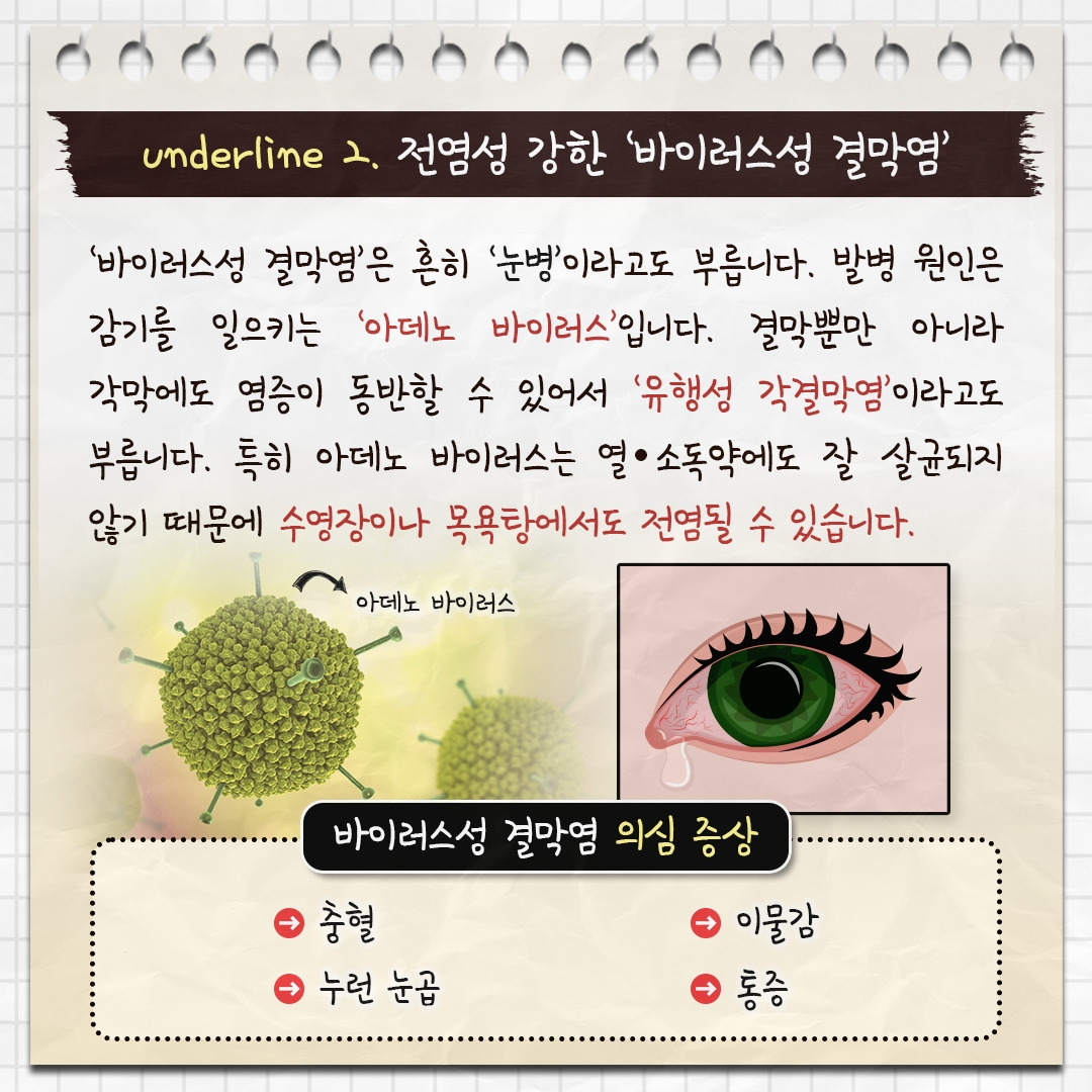 결막염_06.jpg