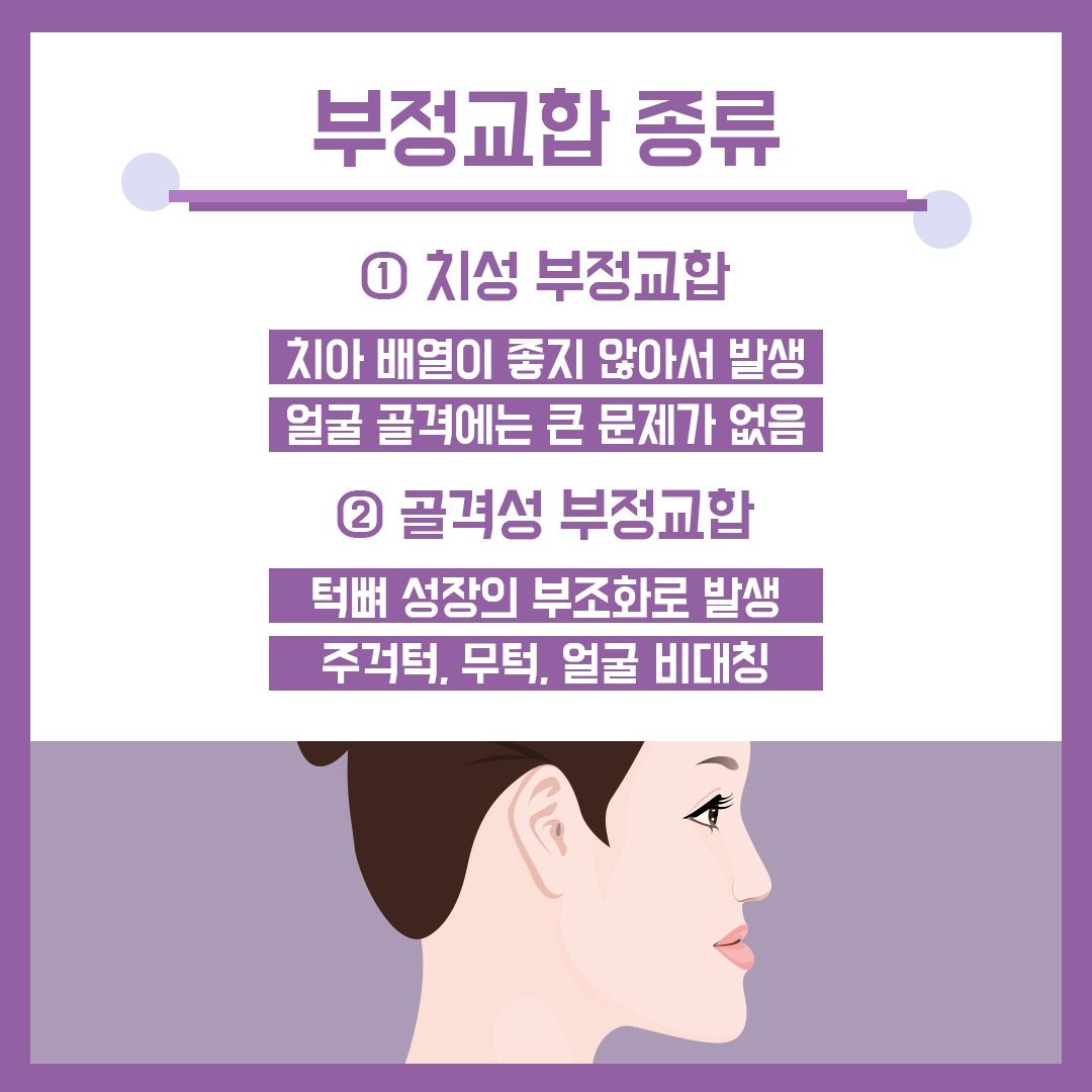 부정교합3.jpg