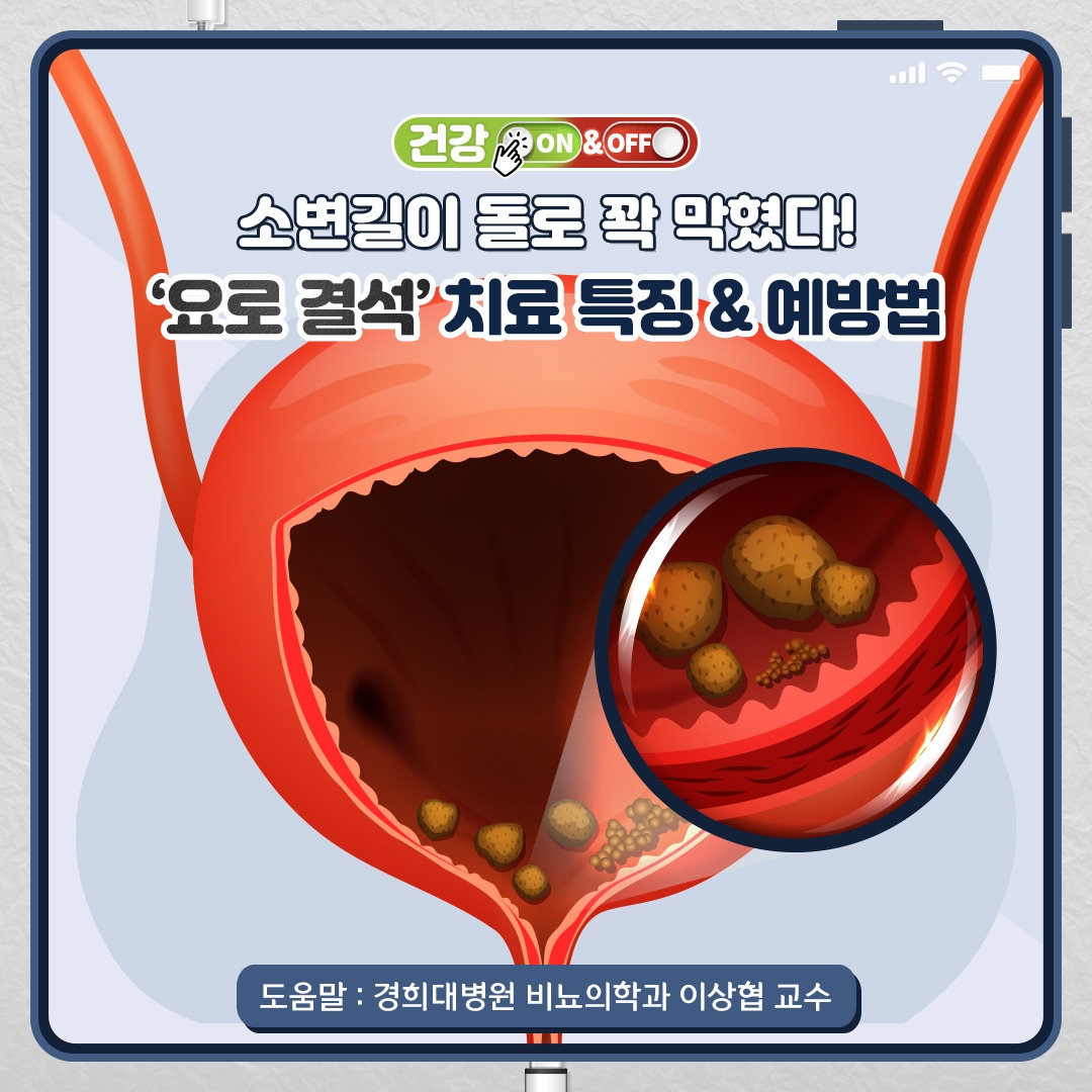 요로결석_01.jpg