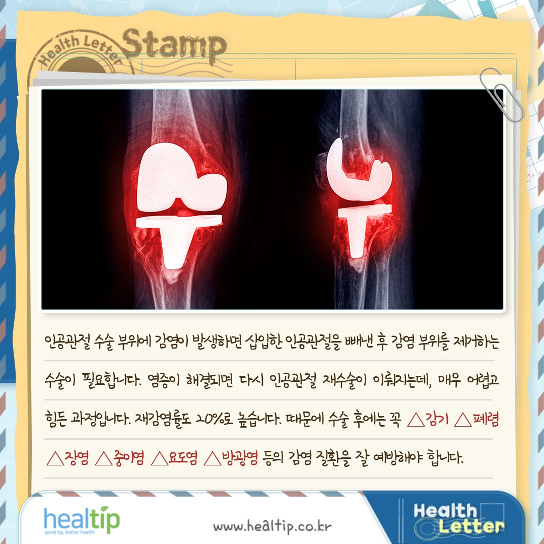 퇴행성무릎관절염_07_힐팁.jpg