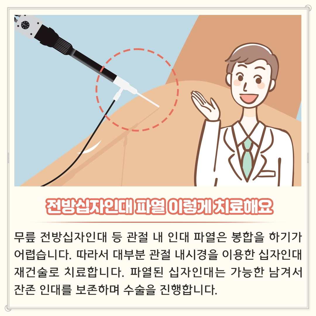 전방십자인대_06.jpg