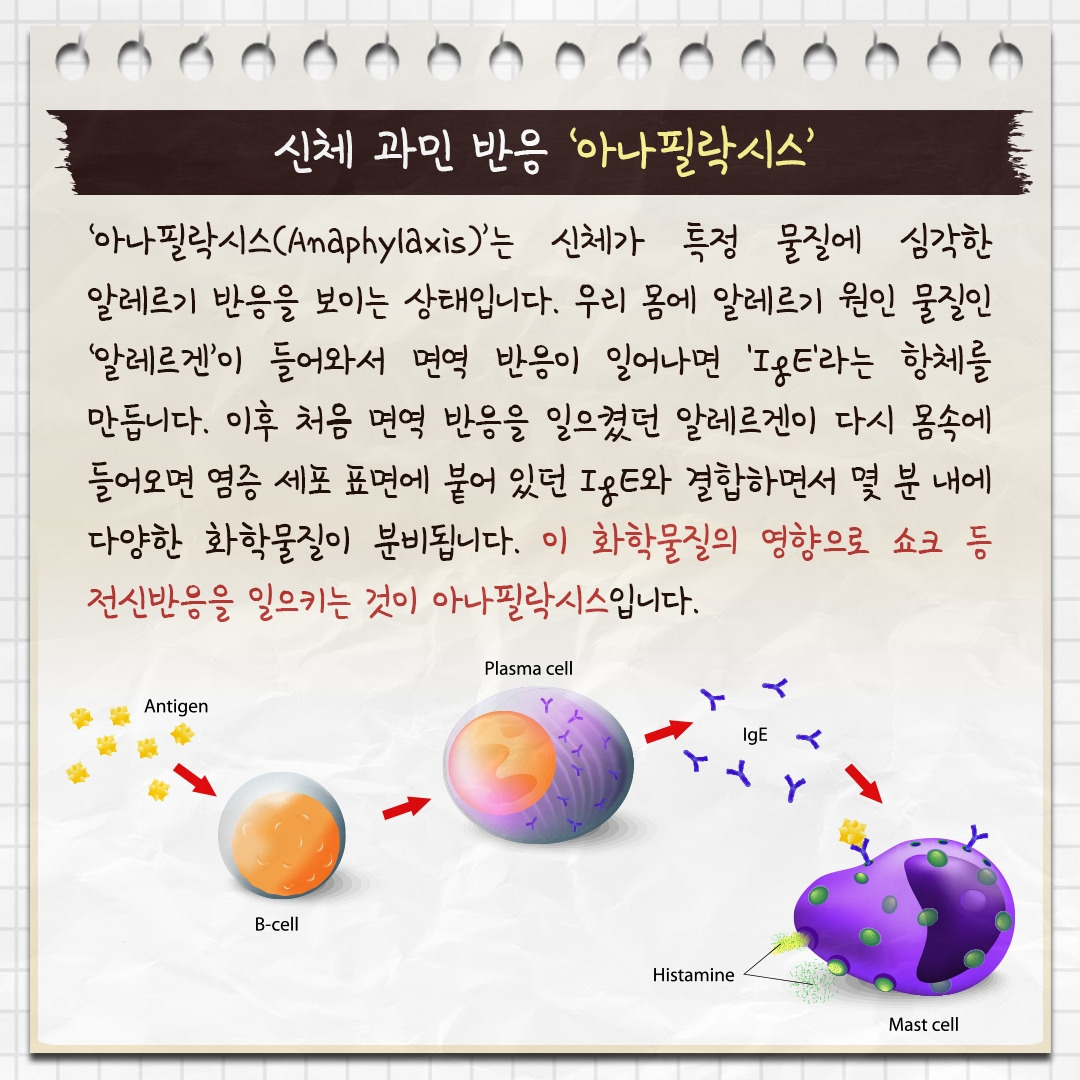 아나필락시스_02.jpg