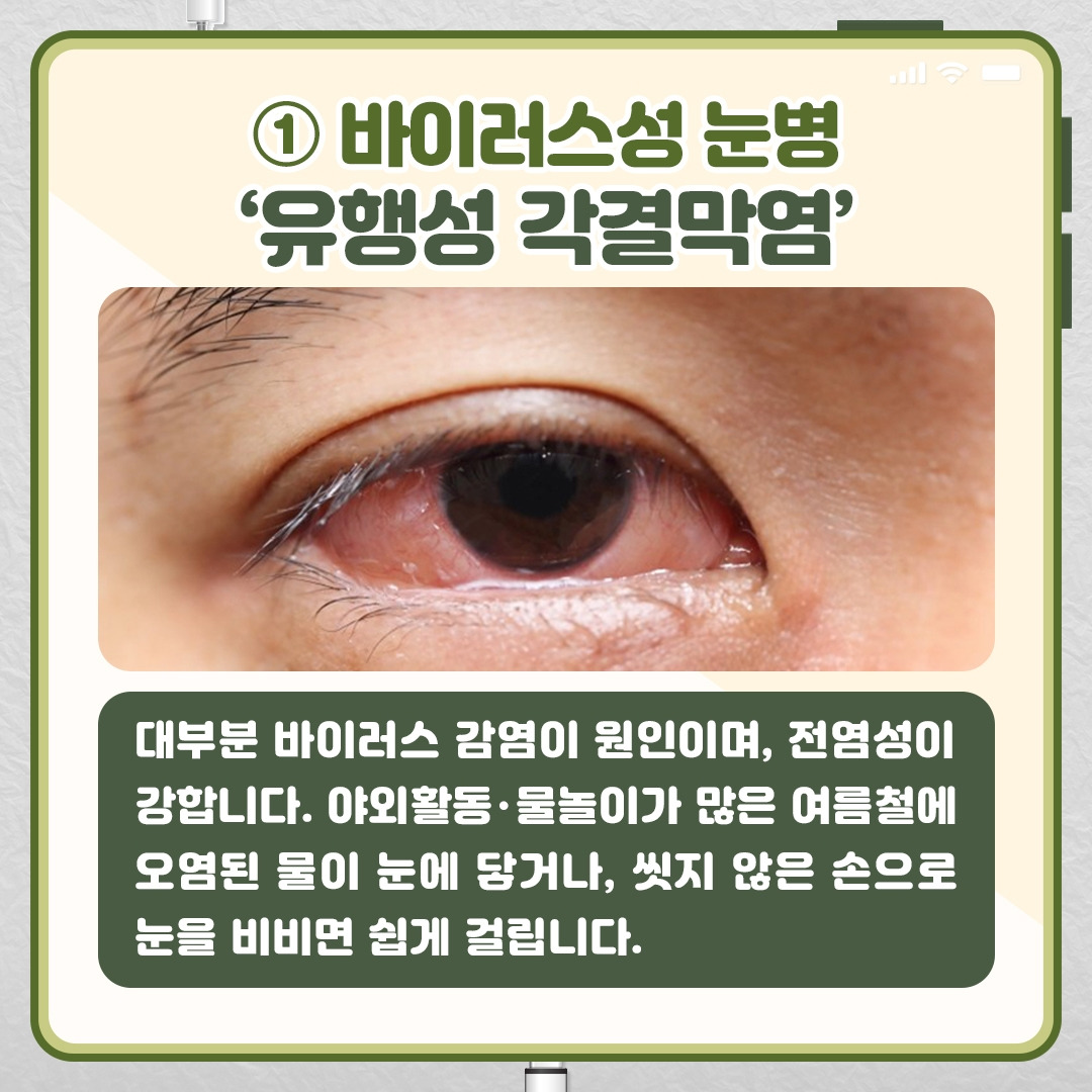 여름눈병_03.jpg