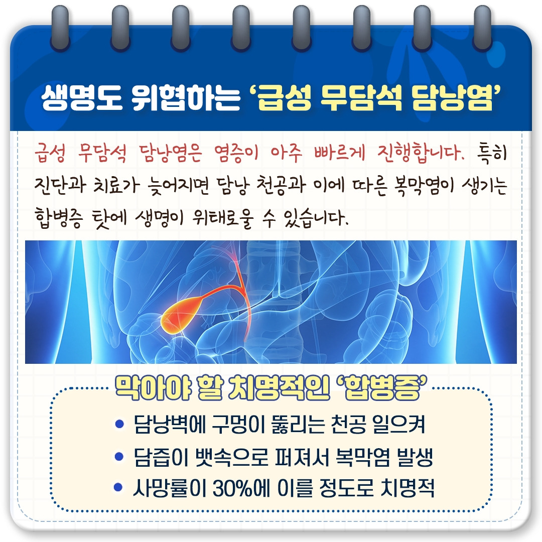 무결석 담낭염_05.jpg